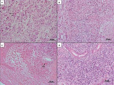 In situ expression of Th17 immunologic mediators in American cutaneous leishmaniasis caused by Leishmania (V.) braziliensis and Leishmania (L.) amazonensis in the Brazilian Amazon